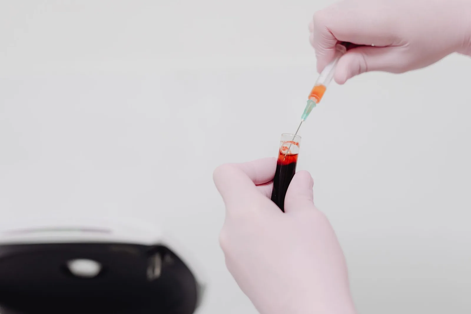 Phân tích tế bào máu để tìm dấu hiệu thalassemia