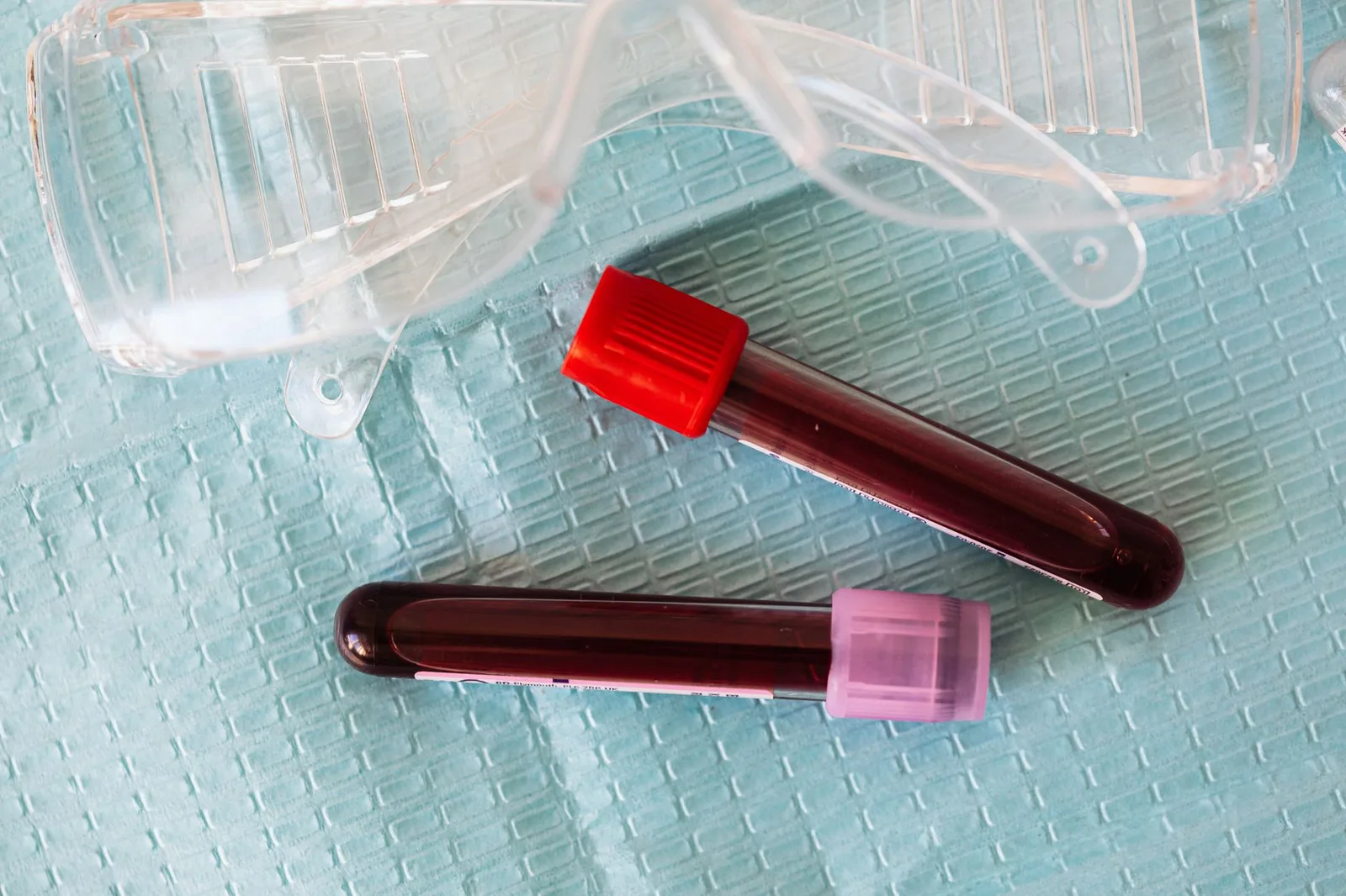 Xét nghiệm máu giúp xác định chỉ số hemoglobin