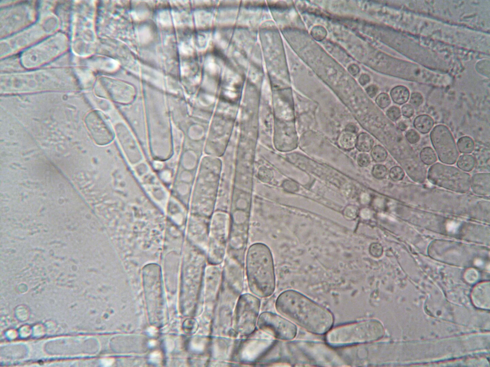 Vi khuẩn Helicobacter pylori dưới kính hiển vi